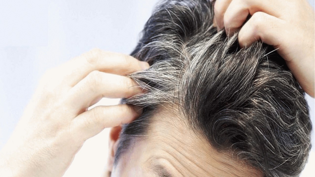 چند اقدام ساده ولی موثر برای جلوگیری و رفع سفیدی مو