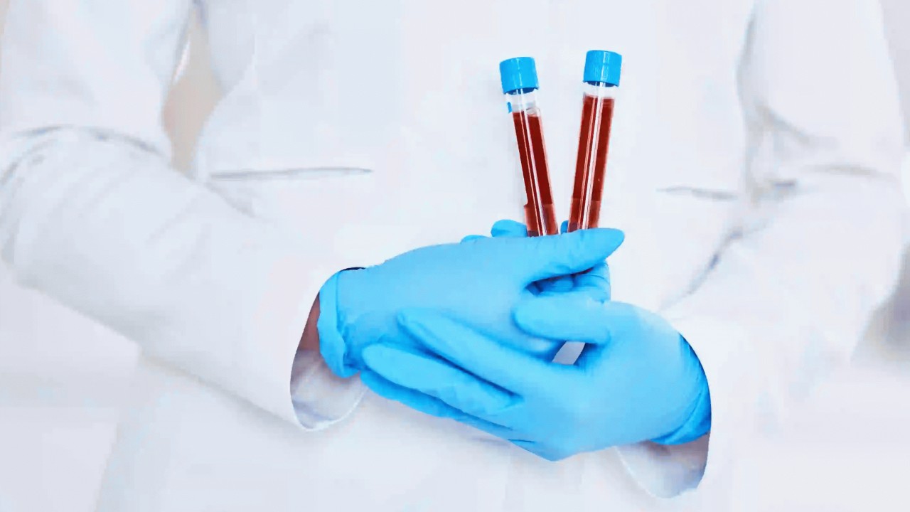 هشت نوع سرطان را با این آزمایش خون تشخیص دهید!